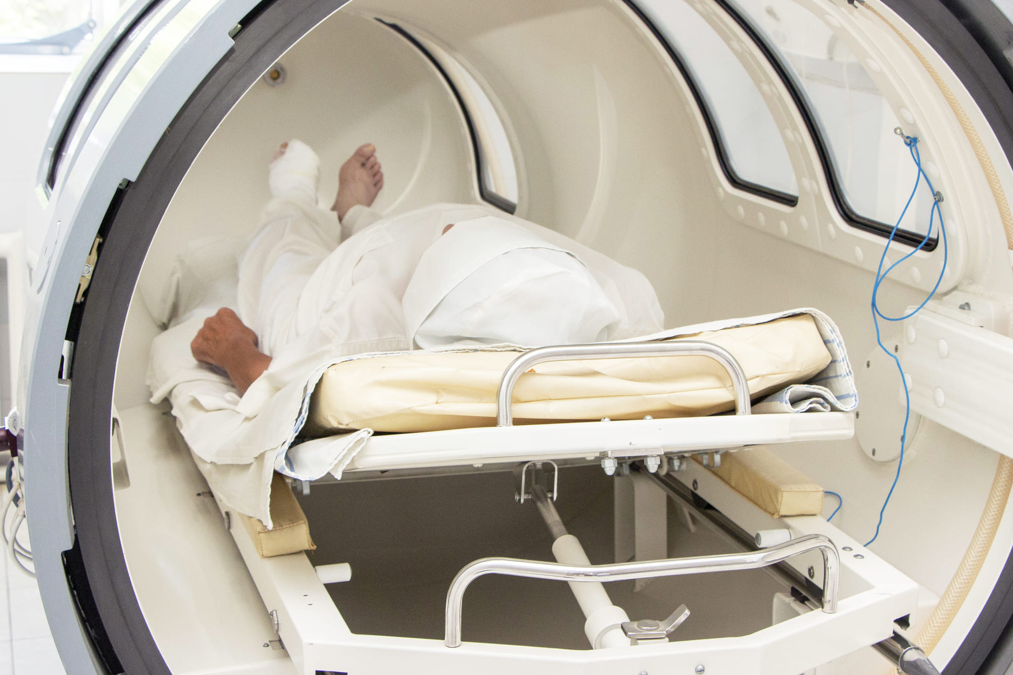 A stroke patient in a hyperbaric oxygen therapy chamber getting treated